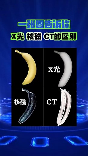 一张图看懂X光、MRI（核磁共振）、CT的区别