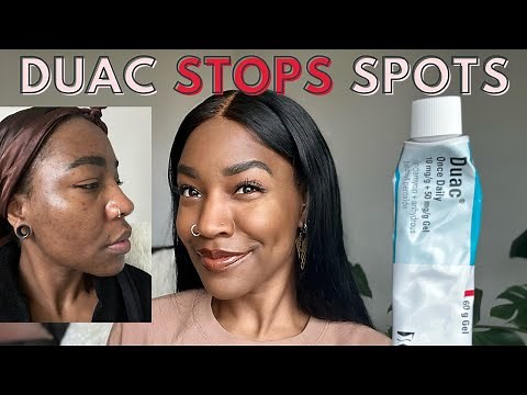DUAC Gel For Acne | Benzoyl Peroxide & Clindamycin | My Experience - DOES DUAC WORK?