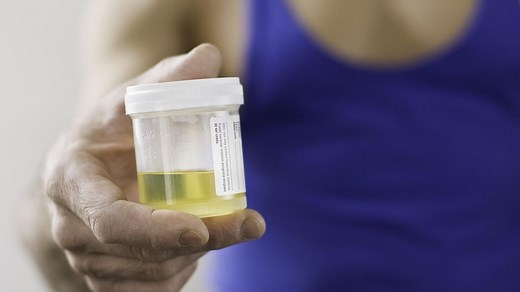 ECBU (Examen cytobactériologique des urines) : définition, indications et résultats