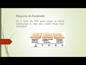 Exame de PPD não deu nada, negativo, tenho tuberculose ?