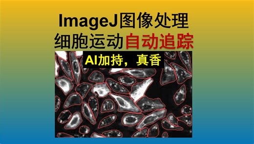 『超实用』ImageJ图像处理 - 人工智能助力运动细胞追踪
