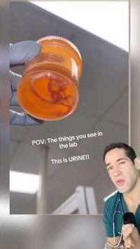 Doctor Reacts: there’s worms in his urine?!