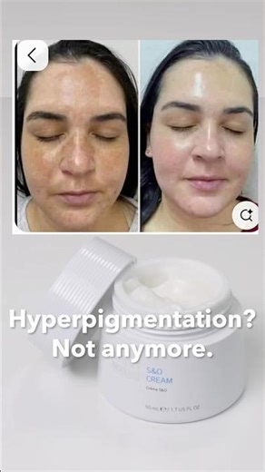 Atomy beauty products | Atomy Absolute | Atomy Europe #atomyeurope #atomy #atomyabsolute #europe2026