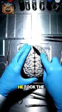 They Stole Einstein’s Brain! 🧠😱 #history#einstein #shorts #weirdhistory#facts #viral #forensics