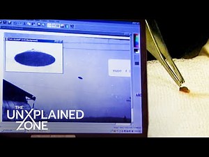 UNEXPLAINABLE Alien Tracker Extracted from Human (Season 2) | UFO Files | The UnXplained Zone