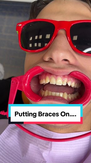 Putting on LightForce 3D Custom Braces Process