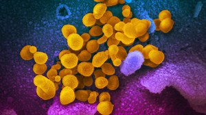 Ohio health leaders warn of children contracting multisystem inflammatory syndrome associated with COVID-19