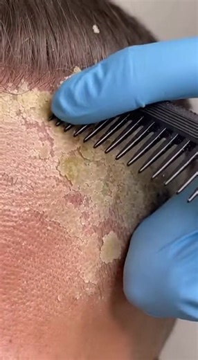 Scalp Care ASMR for Relaxation