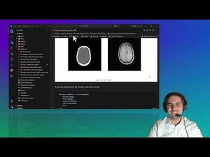 Medical Image Registration: 3D CT & MRI using SimpleITK in Python