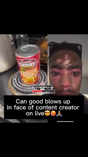 The Real Underground on Instagram: "Is this how u supposed to heat can food🤷🏽‍♂️😢 Lil Jason the content creator from Little Rock took one for the team to show yall the correct way‼️"