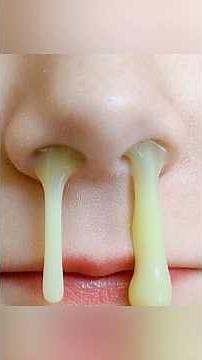 What the Color of Your Mucus Really Means