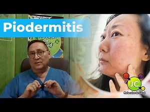 Piodermitis (infecciones de la piel)