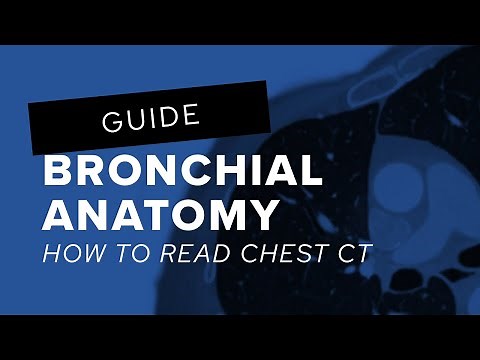 How to read chest CT: bronchial anatomy