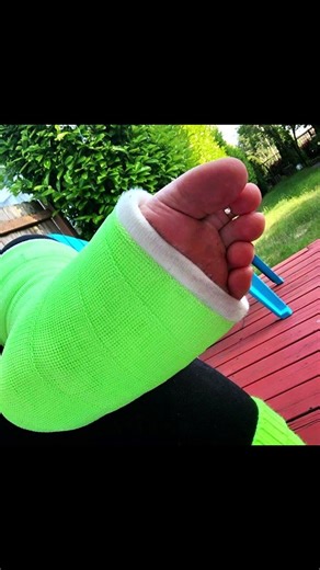 Best Girls Casted Toes 2