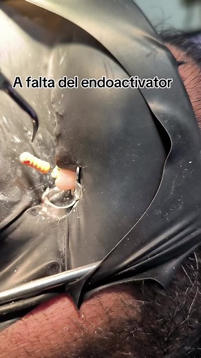 Videos de Danny Dent Consultorio Dental (@dannyboyelgallo2) con “sonido original - Danny Dent Consultorio Dental”