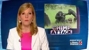 A vicious chimp attack made world headlines. Now after 22 surgeries see this St. Louisan's amazing transformation. The exclusive interview Sunday after the Super Bowl and Blacklist on NewsChannel 5. | KSDK News