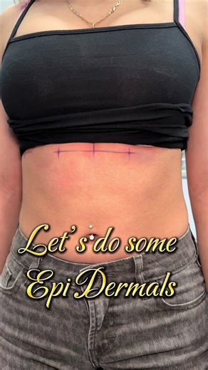 I’m going to call these Epi Dermals ✨💖 Thank you @Valerya for allowing me to get these on video 🔥 the faces you made were too funny girl 😂👹 I was VERY THOROUGH on what not to do or wear during her healing process. She knows these can get snagged.. just as any piercing can. They look SO GOOD on her & I actually would love do to more of em!! So HMU if you trying to get these done 🥹🔥 #modernmodsaz #piercings #fyp