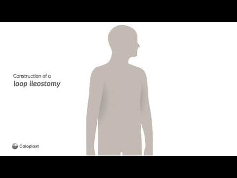 Anatomy of Loop Ileostomy Construction