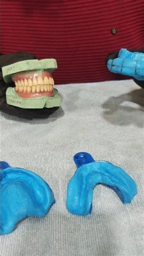 Complete Upper & Lower Dentures | Perfect Bite Registration Case