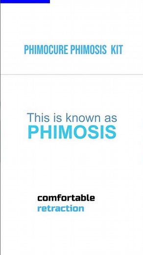 Phimocure phimosis tight foreskin kit - how to pull back your foreskin at home 2023