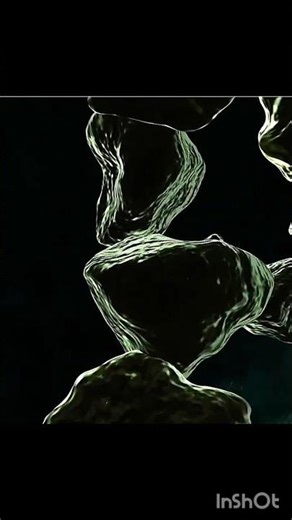 "Gall Bladder Stone"