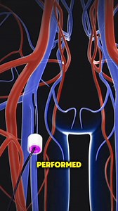 Cardiac Ablation Surgery (3D Animation) #facts #randomfacts #learnontiktok #curiosity #satisfying #satisfyingvideos #MedicalEducation #medicalfacts | MindfulFacts