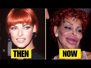10 Celebrities Before and After Plastic Surgery | Then and Now 2026
