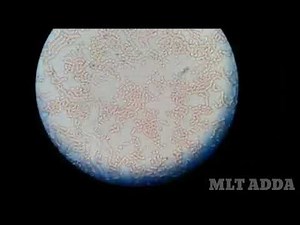 filaria live seen in microscopic examination,