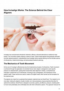 How Invisalign Works The Science Behind the Clear Aligners - SlideServe