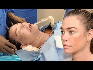 Inside Denise Richards' Facelift: Never-Before-Seen Footage From Shocking Transformation (Exclusive)