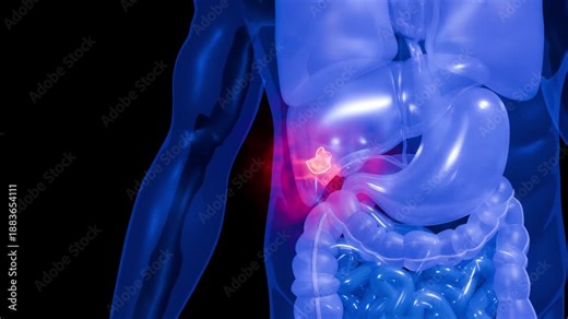 Hepatocellular Carcinoma Concept Showing Cancerous Lesion in Liver with Transparent Human Anatomy X Ray View