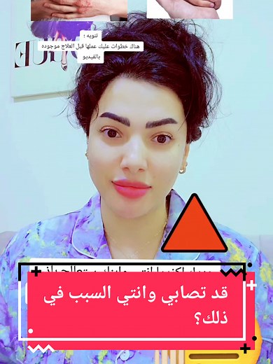 علاج الاكزيما على الوجه: طرق فعالة للبشرة الصحية