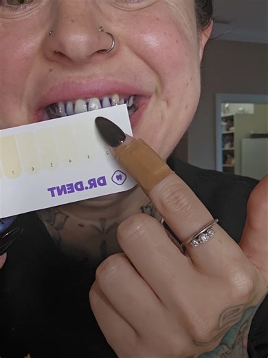 Transform Your Smile with This Tooth Magic Trick