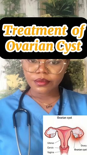 Effective Methods for Ovarian Cyst Treatment