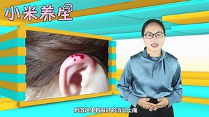 耳尖放三滴血，放出多种疾病，疗效显著且易操作，真人示范