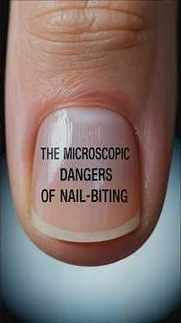 150 Different Bacteria Species Are Living On Your Fingernails RIGHT NOW!