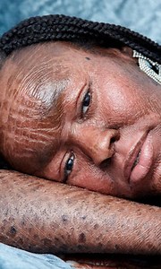 I'm owning my skin condition by modelling for Glamour ✨ | Shake My Beauty