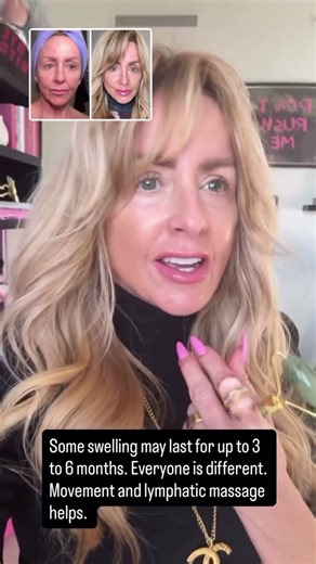 Day 12 Post-Facelift: Surgeon Removes Stitches & Shares Massage Tip