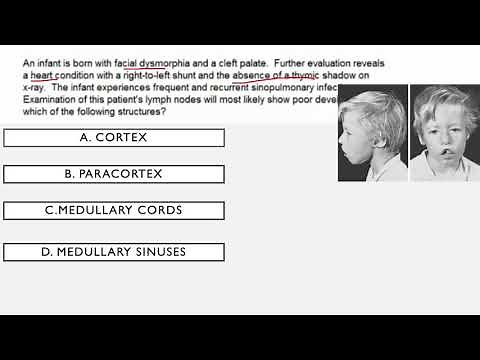 Immunodeficiency Syndromes USMLE Questions