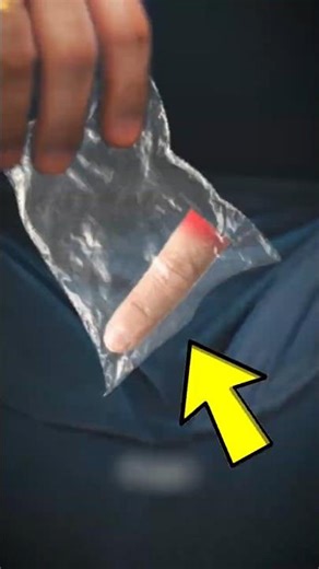 Cut Off a Finger? This One Mistake Can Ruin It