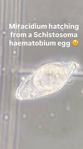 2.1K reactions · 361 shares |  What is happening?: Miracidium...