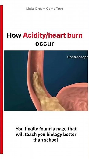 🔥How Acidity/🫀heart burn occur | MDCT