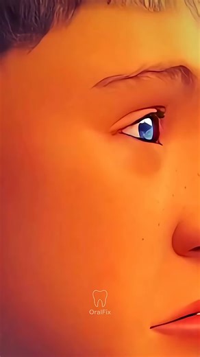 Did you know a crossbite is when your upper and lower teeth don’t line up the way they should? Instead of the top teeth sitting outside the bottom teeth, they bite inside or at odd angles. This can lead to uneven wear, jaw pain, and long-term changes to your smile. Orthodontists fix it using braces, clear aligners, or expanders to gently guide the teeth and jaw into the right position. Over months to years, your bite becomes balanced, chewing gets easier, and your smile looks more natural.” #Cro