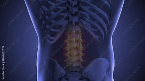 Anatomy of soreness in the lower back