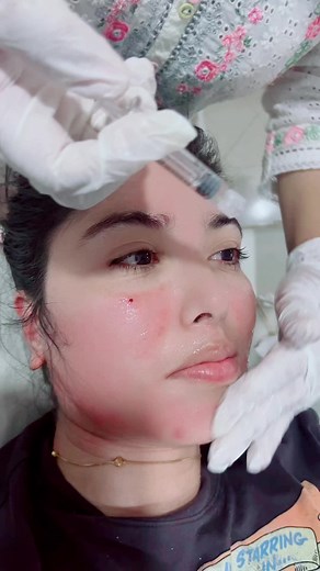 Pooja Sharma Glows with Cell Fusion C Skincare at Korean Skin Care Clinic