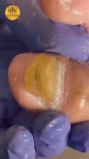 558. Grocery run calorie awareness and portion tips #CalorieControl #SmartEating #HeartHealthyDiet | LOS A-T BOYZ