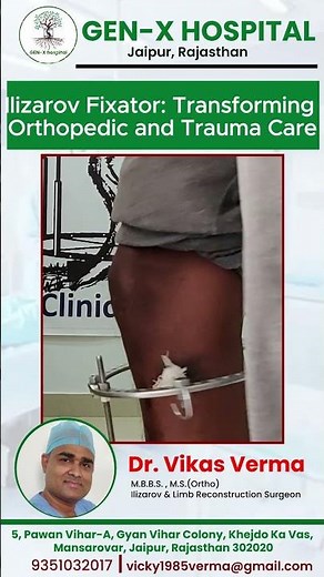 Ilizarov Fixator Transforming Orthopedic and Trauma