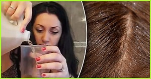 How To Use Apple Cider Vinegar To Cure Dandruff: Benefits   Side Effects