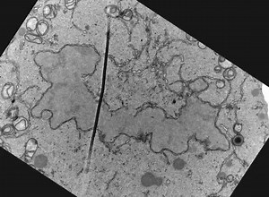 File:Acute-Manipulation-of-Diacylglycerol-Reveals-Roles-in-Nuclear-Envelope-Assembly-&-Endoplasmic-pone.0051150.s009.ogv - Wikimedia Commons