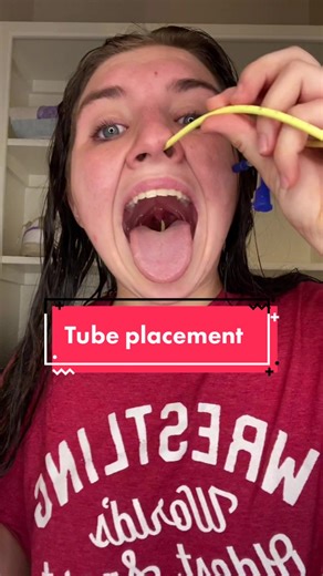 NG Tube Installation and Replacement: A Comprehensive Guide